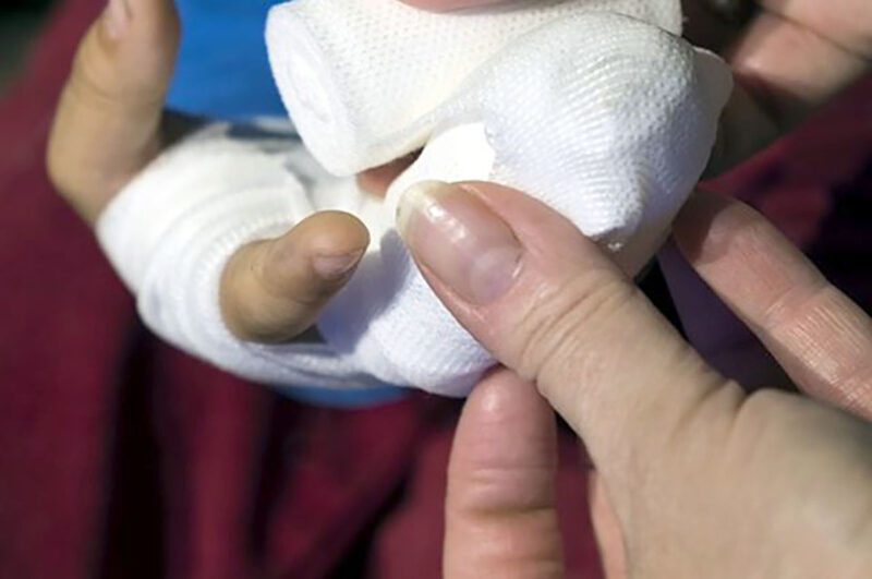 Все решит суд: в Павлодаре ребенку в детсаде отрубило палец